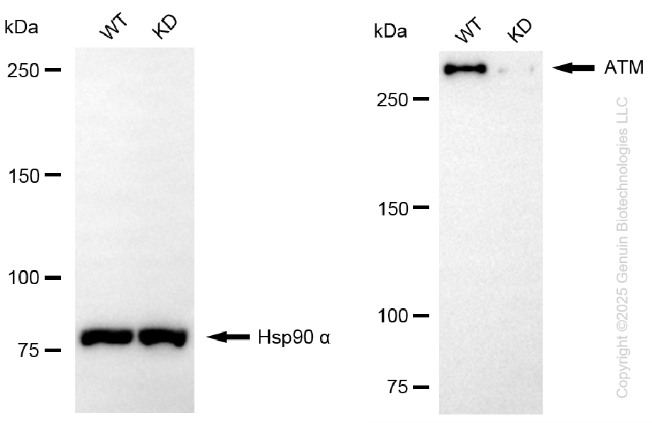 WB - KO Validated Anti-ATM Rabbit Monoclonal Antibody AGI2406